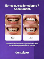 Dentaluxe White Ritual